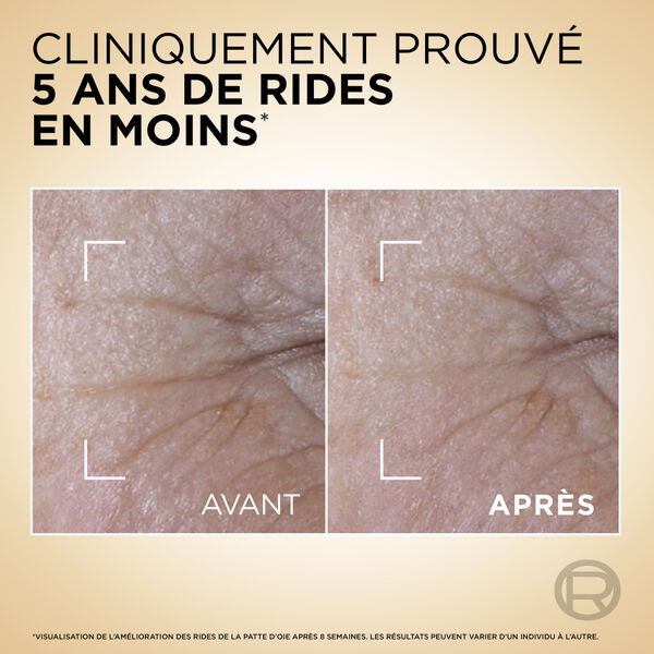 Age Perfect Cell Renew L'Oréal Paris