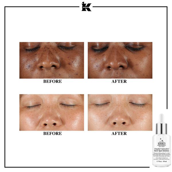 Clearly Corrective™ Dark Spot Solution Kiehl s